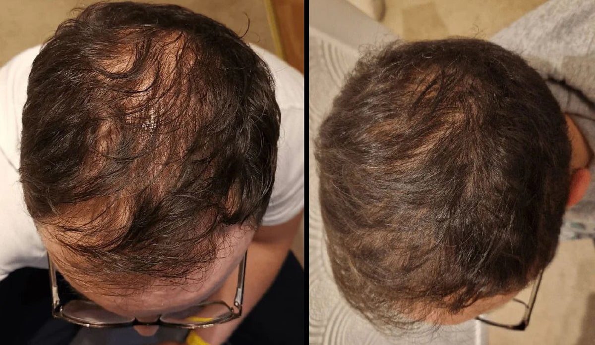 Progetto senza titolo - 2025-11-19T231440.541.jpg__PID:56a4e2ec-5e33-4e26-8a13-ff97afade069