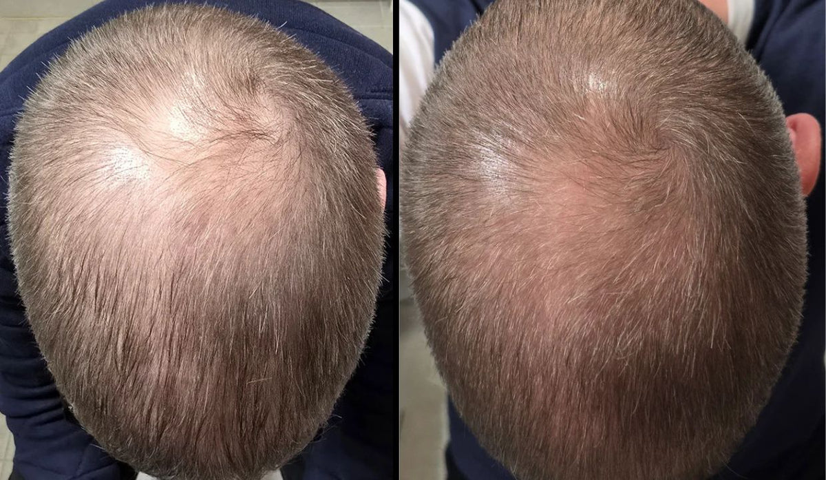 Progetto senza titolo - 2025-11-19T232227.176.jpg__PID:98637aac-4ab4-4394-9c63-1ea2e8dd5e44