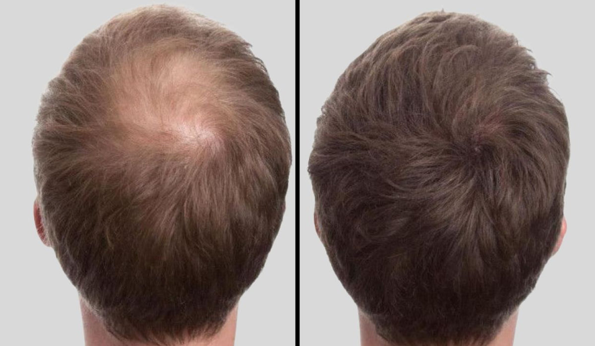 Progetto senza titolo - 2025-11-19T235746.678.jpg__PID:ef6543ff-86b5-4ebd-800a-447864d7e2ad