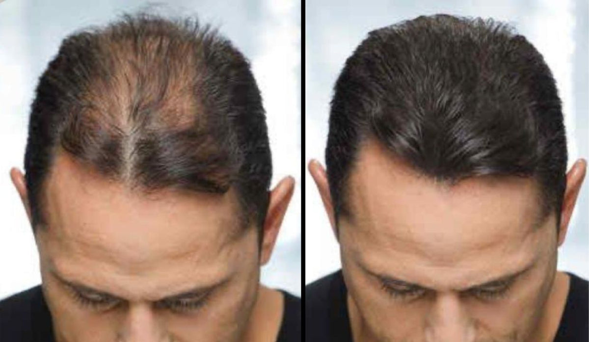 Progetto senza titolo - 2025-11-20T000900.118.jpg__PID:da661738-e0f3-4faf-ab9b-3521398b6222