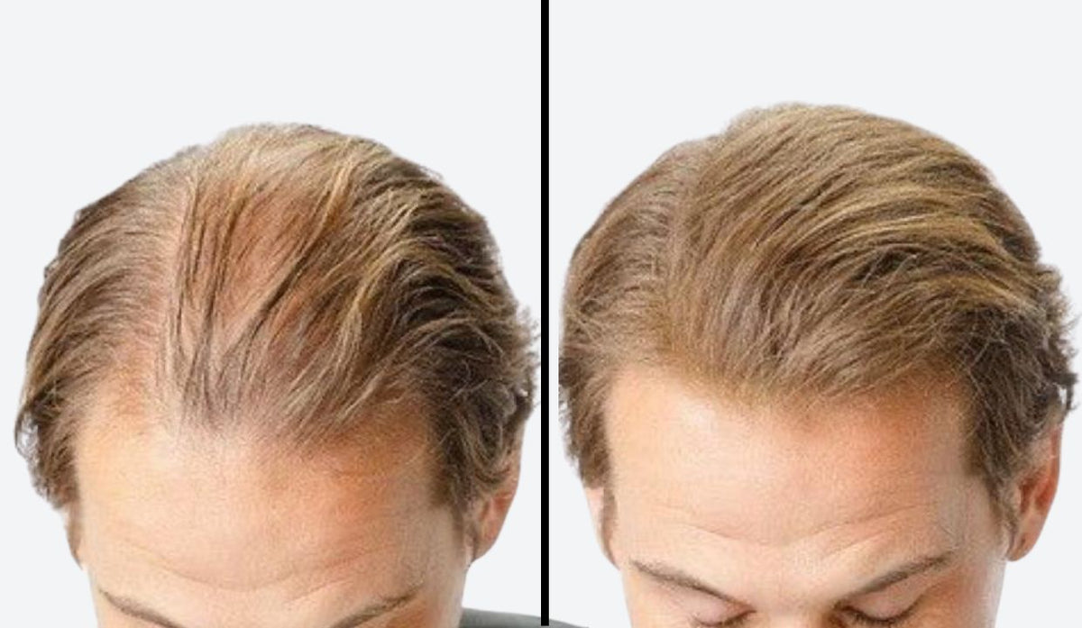 Progetto senza titolo - 2025-11-20T002153.778.jpg__PID:a219a34c-3f45-45b1-90c2-7cc086fe53f4